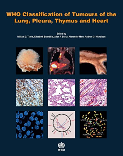 Who Classification of Tumours of the Lung, Pleura, Thymus and Heart (World Health Organization Classification of Tumours, Band 7)